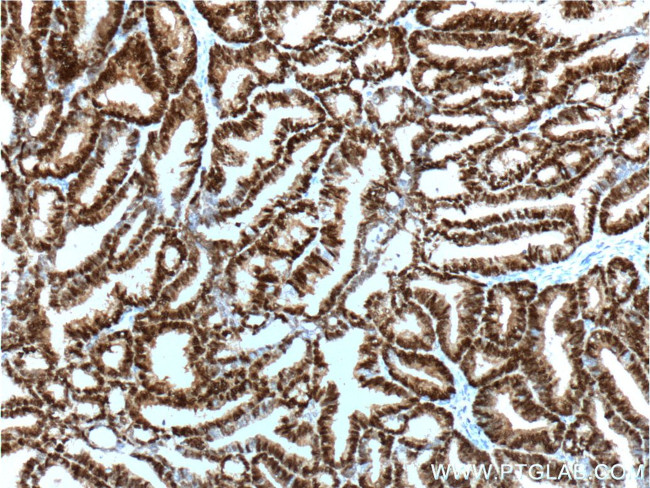 PR Antibody in Immunohistochemistry (Paraffin) (IHC (P))