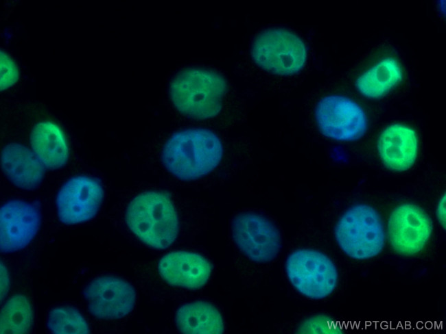 PR Antibody in Immunocytochemistry (ICC/IF)