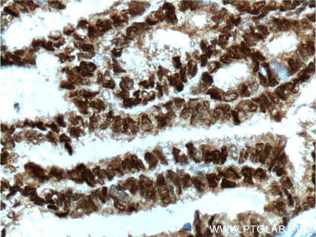 PR Antibody in Immunohistochemistry (Paraffin) (IHC (P))