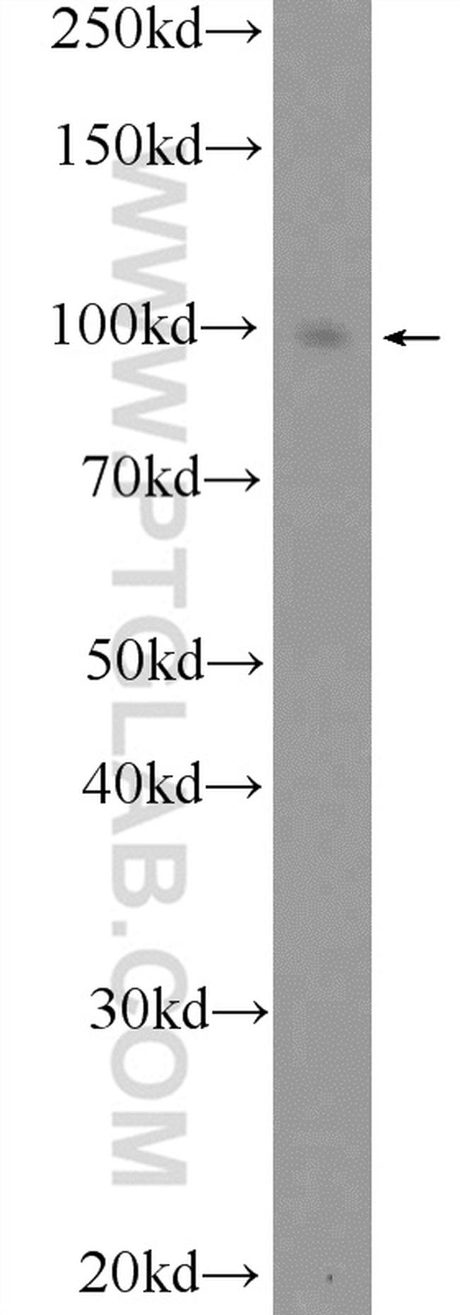 PR Antibody in Western Blot (WB)