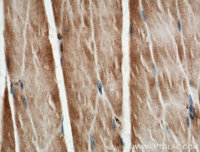 HKDC1 Antibody in Immunohistochemistry (Paraffin) (IHC (P))