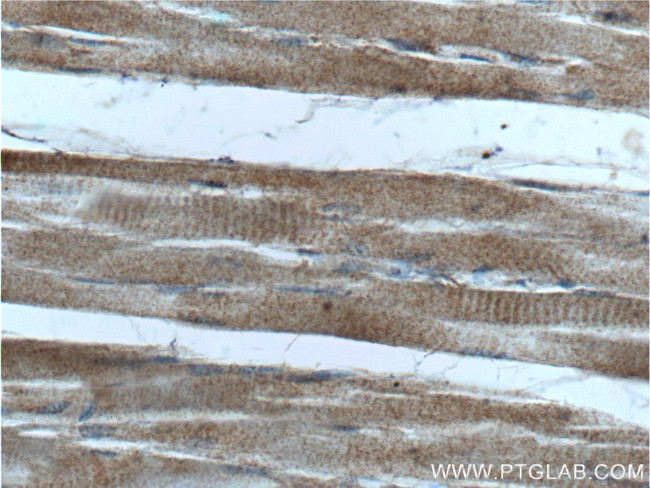 HKDC1 Antibody in Immunohistochemistry (Paraffin) (IHC (P))