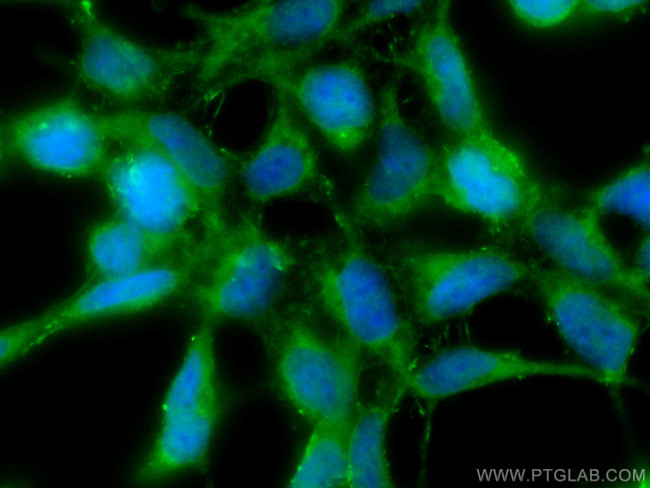 Chk1 Antibody in Immunocytochemistry (ICC/IF)