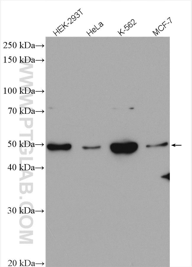 Chk1 Antibody in Western Blot (WB)