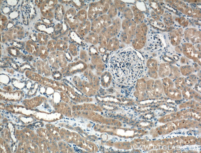 Chk1 Antibody in Immunohistochemistry (Paraffin) (IHC (P))