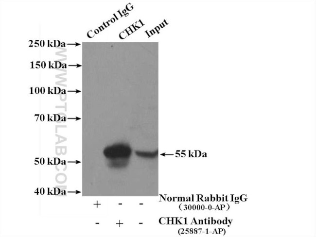 Chk1 Antibody in Immunoprecipitation (IP)