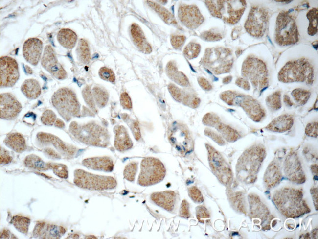 EDA Antibody in Immunohistochemistry (Paraffin) (IHC (P))