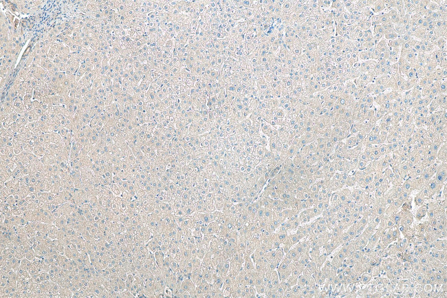 EDA Antibody in Immunohistochemistry (Paraffin) (IHC (P))