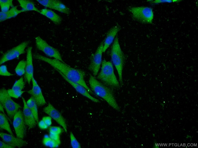 MTR Antibody in Immunocytochemistry (ICC/IF)