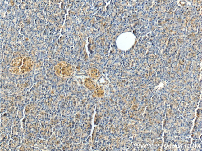 MTR Antibody in Immunohistochemistry (Paraffin) (IHC (P))