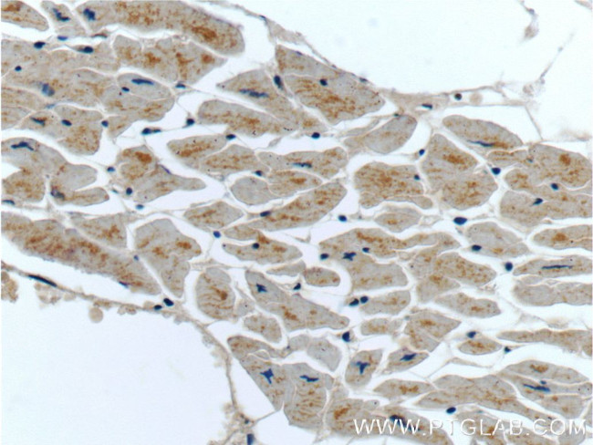 MTR Antibody in Immunohistochemistry (Paraffin) (IHC (P))