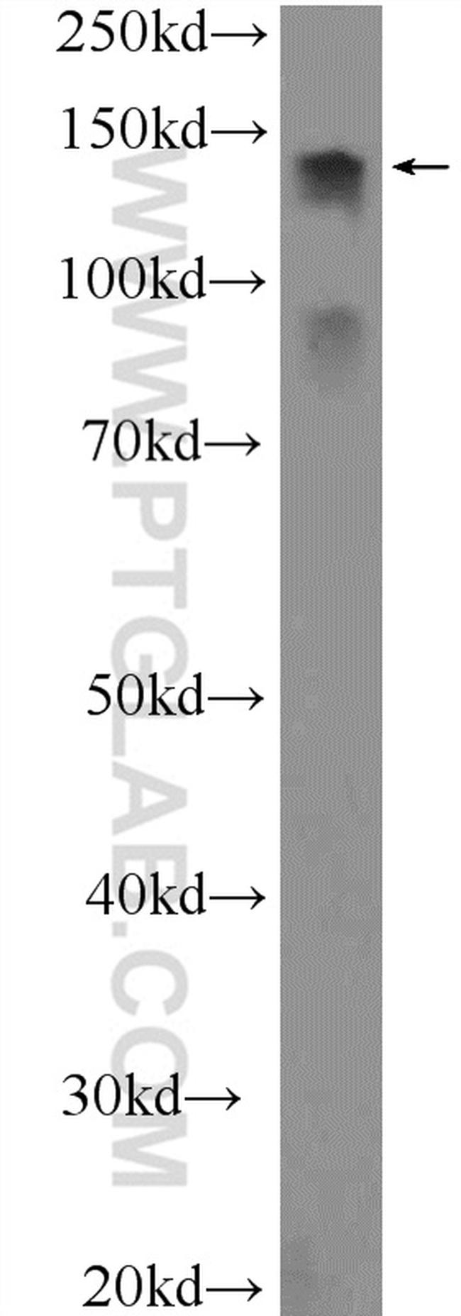 MTR Antibody in Western Blot (WB)