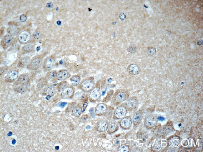 KIF5C Antibody in Immunohistochemistry (Paraffin) (IHC (P))