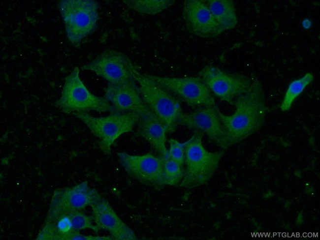 KIF5C Antibody in Immunocytochemistry (ICC/IF)