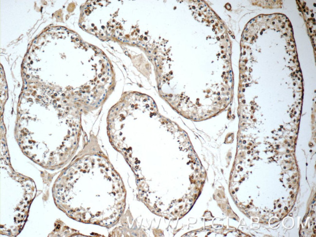 KIF5C Antibody in Immunohistochemistry (Paraffin) (IHC (P))