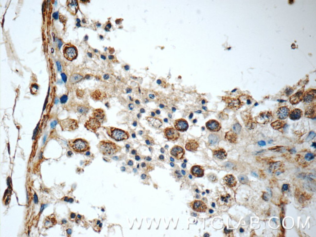 KIF5C Antibody in Immunohistochemistry (Paraffin) (IHC (P))