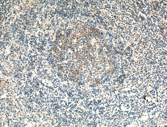 CCR7 Antibody in Immunohistochemistry (Paraffin) (IHC (P))