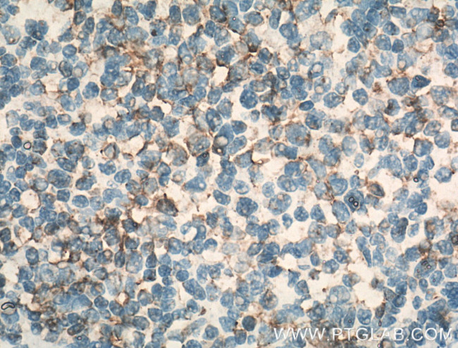 CCR7 Antibody in Immunohistochemistry (Paraffin) (IHC (P))