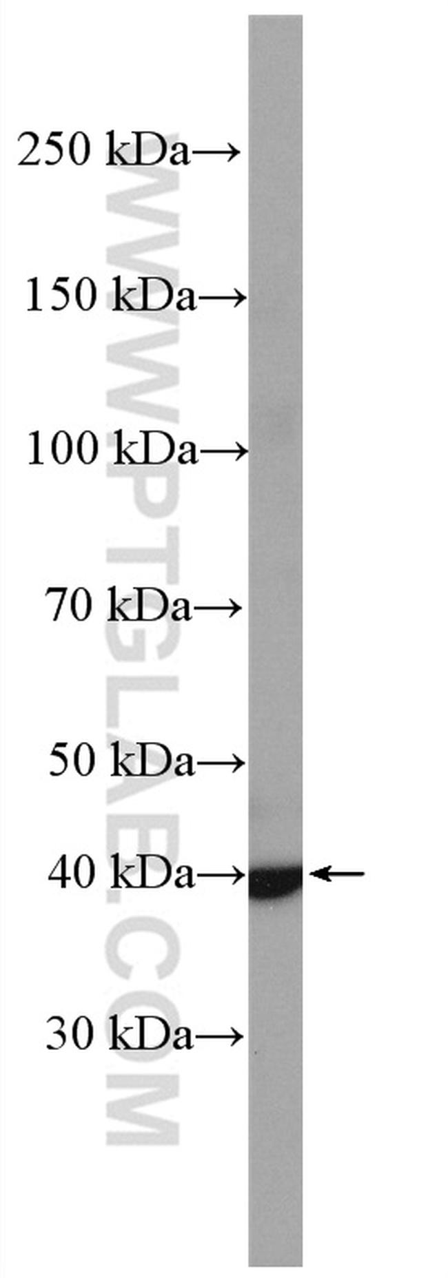 CCR7 Antibody in Western Blot (WB)