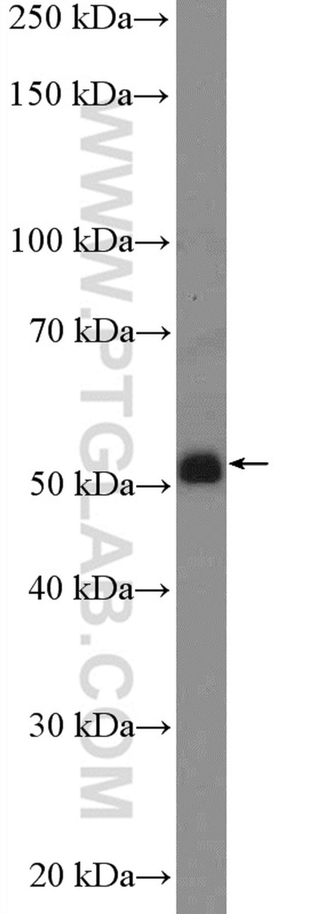 GABRR1 Antibody in Western Blot (WB)