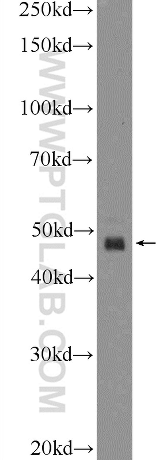 GABRR1 Antibody in Western Blot (WB)