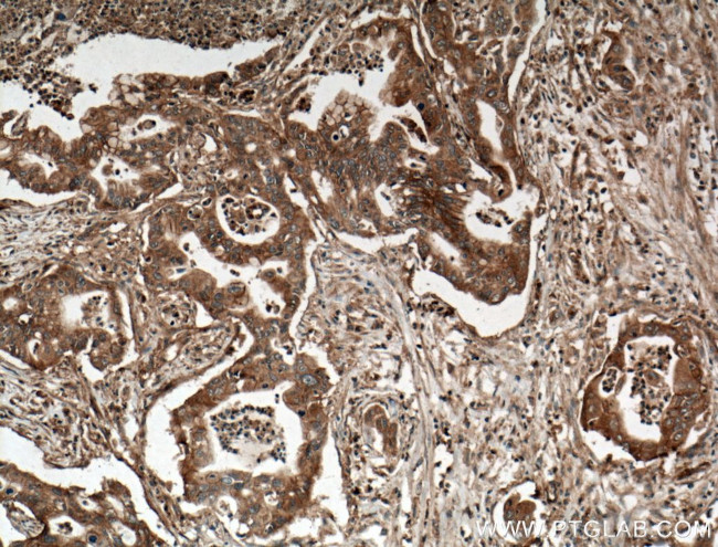 ADAM10 Antibody in Immunohistochemistry (Paraffin) (IHC (P))