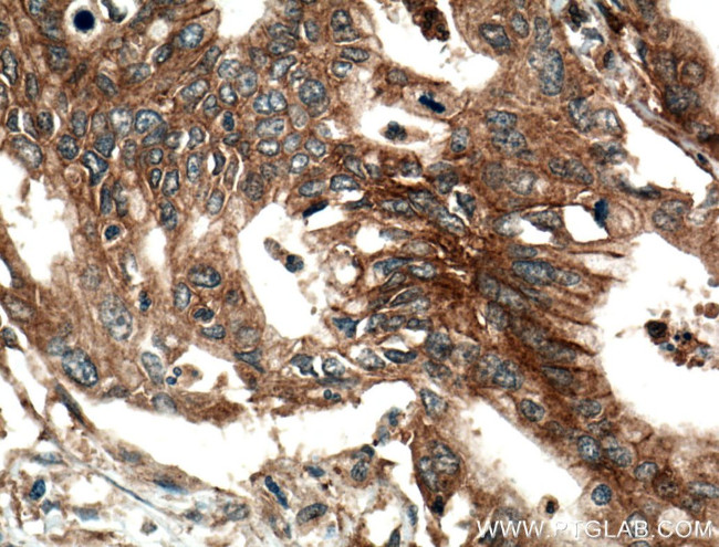 ADAM10 Antibody in Immunohistochemistry (Paraffin) (IHC (P))