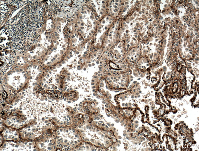 ADAM10 Antibody in Immunohistochemistry (Paraffin) (IHC (P))