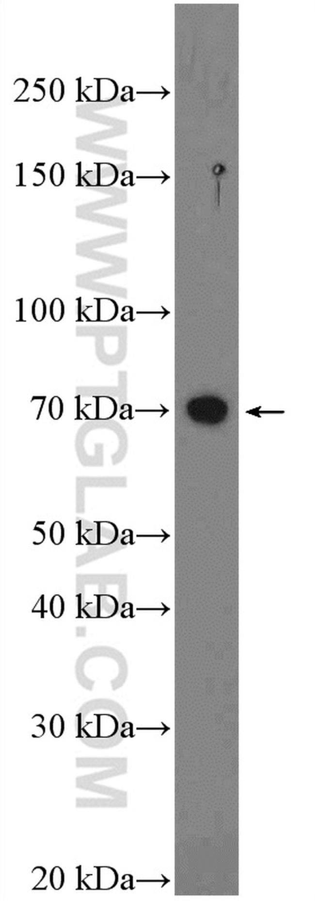 ADAM10 Antibody in Western Blot (WB)