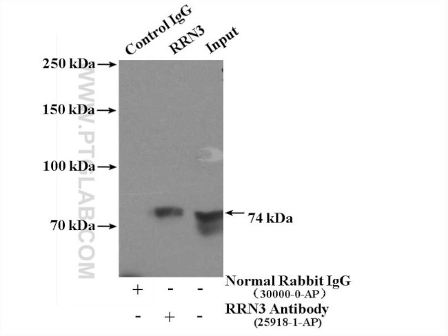 RRN3 Antibody in Immunoprecipitation (IP)