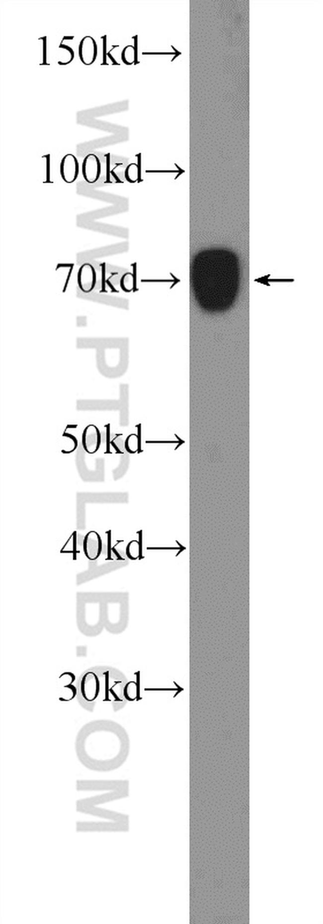 RRN3 Antibody in Western Blot (WB)