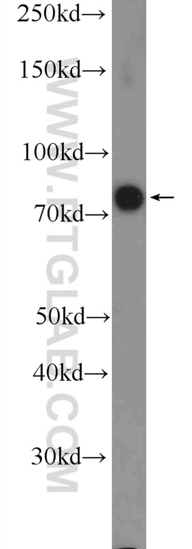 RRN3 Antibody in Western Blot (WB)