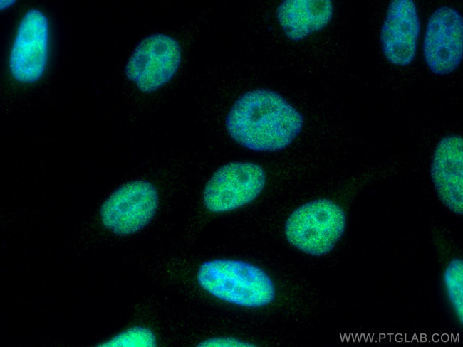 SNW1 Antibody in Immunocytochemistry (ICC/IF)