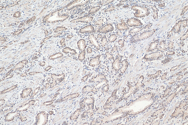 SNW1 Antibody in Immunohistochemistry (Paraffin) (IHC (P))