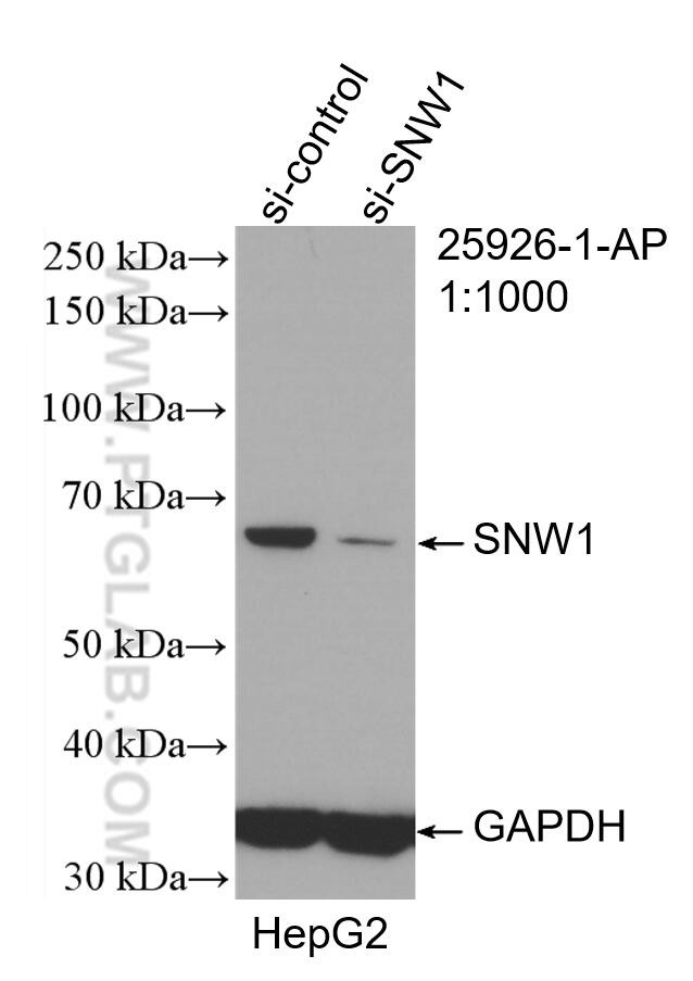 SNW1 Antibody in Western Blot (WB)