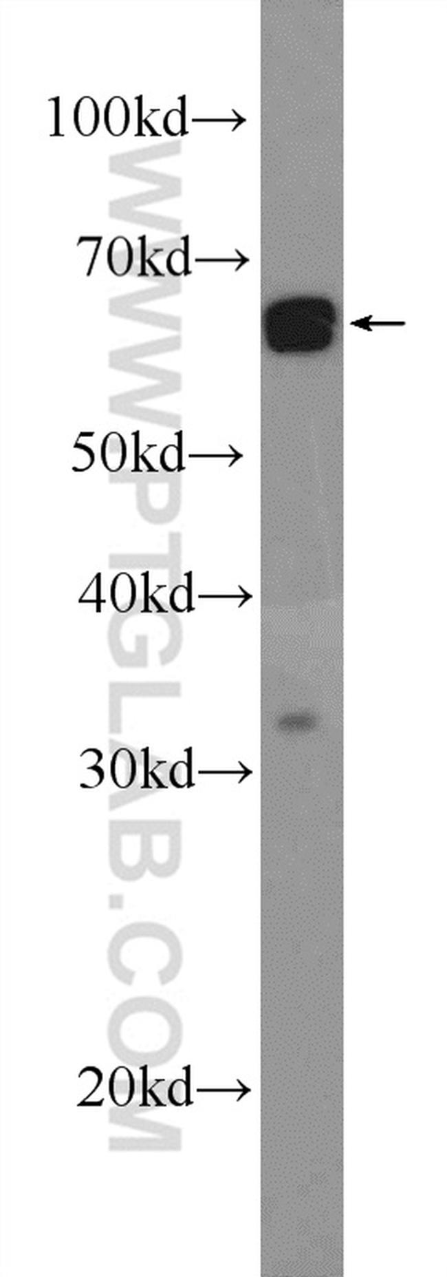 SNW1 Antibody in Western Blot (WB)