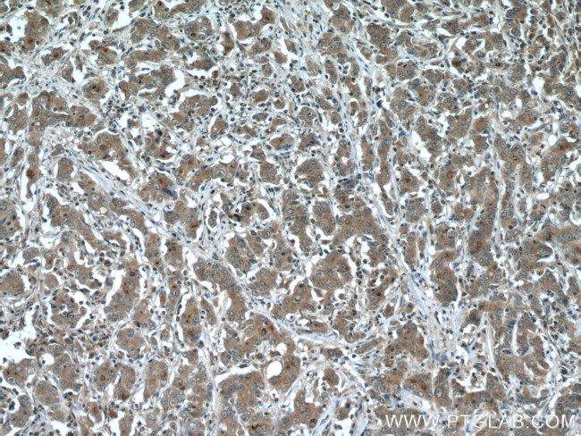 IQGAP3 Antibody in Immunohistochemistry (Paraffin) (IHC (P))