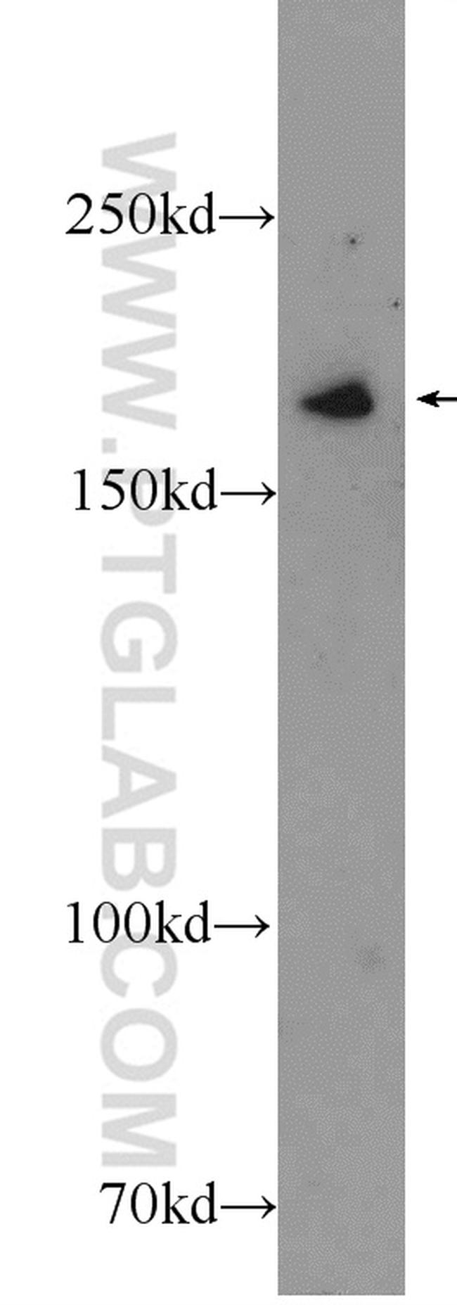 IQGAP3 Antibody in Western Blot (WB)