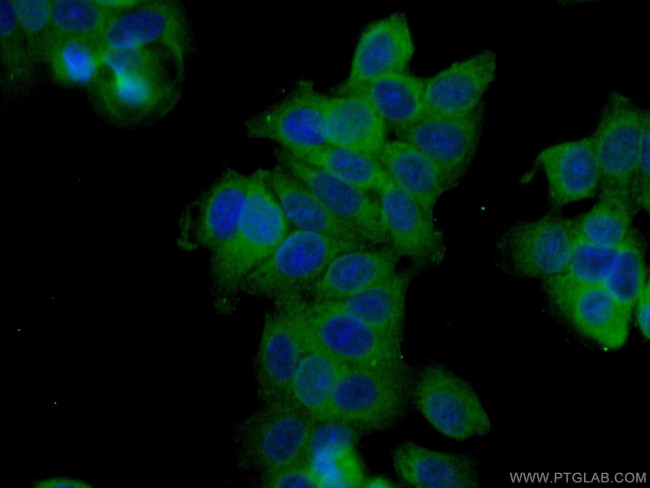 TCHP Antibody in Immunocytochemistry (ICC/IF)