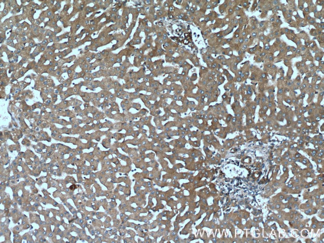 TCHP Antibody in Immunohistochemistry (Paraffin) (IHC (P))