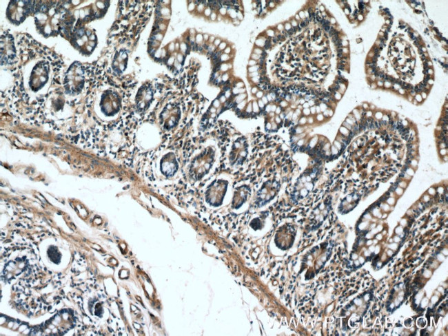 TCHP Antibody in Immunohistochemistry (Paraffin) (IHC (P))