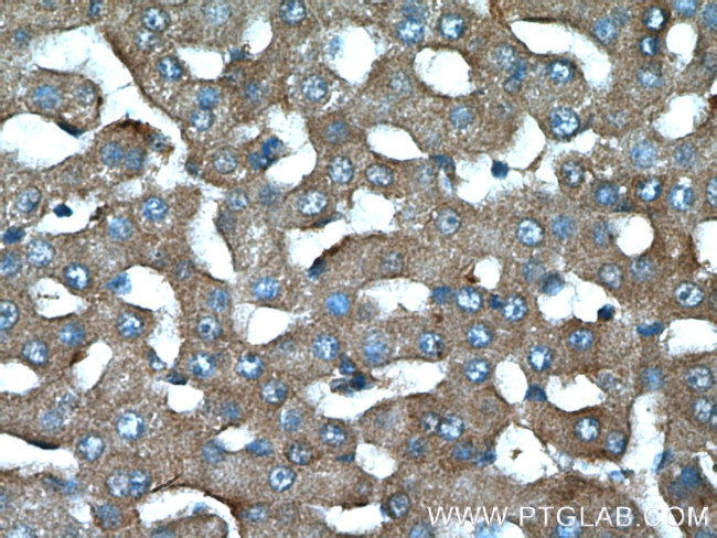 TCHP Antibody in Immunohistochemistry (Paraffin) (IHC (P))