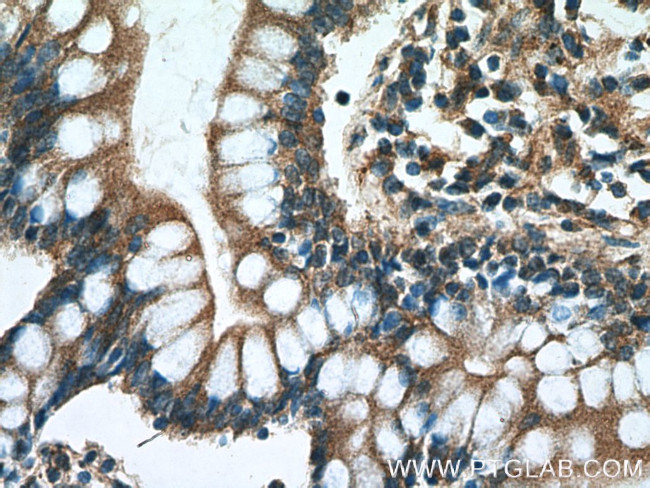 TCHP Antibody in Immunohistochemistry (Paraffin) (IHC (P))