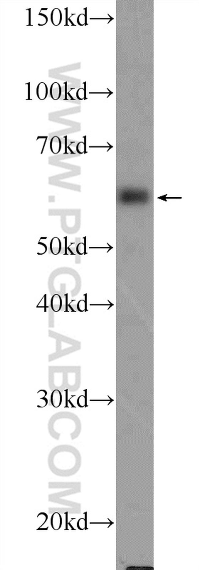 TCHP Antibody in Western Blot (WB)