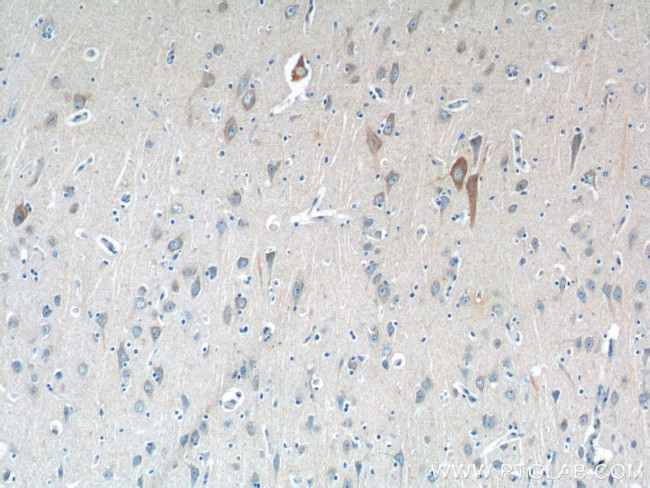 CSF1R Antibody in Immunohistochemistry (Paraffin) (IHC (P))