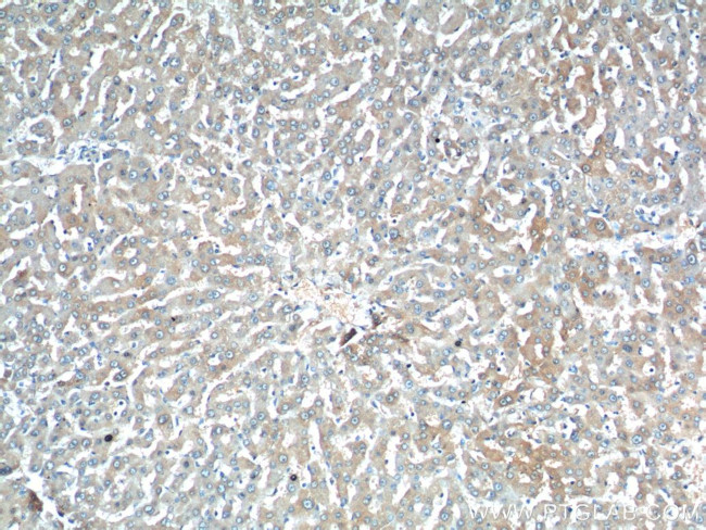 C11orf80 Antibody in Immunohistochemistry (Paraffin) (IHC (P))