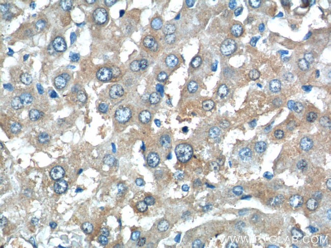 C11orf80 Antibody in Immunohistochemistry (Paraffin) (IHC (P))