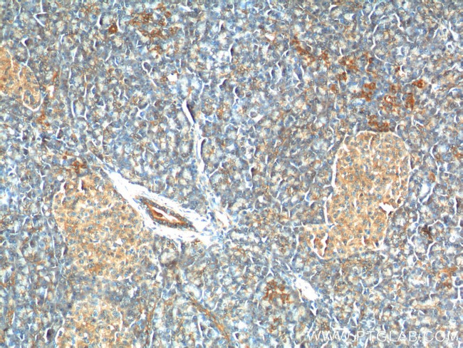 C11orf80 Antibody in Immunohistochemistry (Paraffin) (IHC (P))