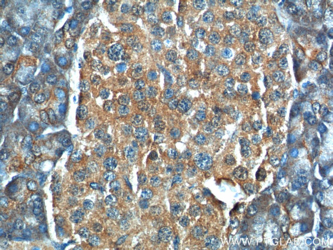 C11orf80 Antibody in Immunohistochemistry (Paraffin) (IHC (P))