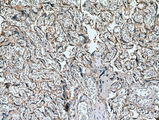 SLC19A1 Antibody in Immunohistochemistry (Paraffin) (IHC (P))